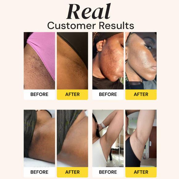 Feature product image